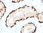 Melanoma Antigen Family A, 4/MAGEA4 Monoclonal Antibody (CPTC-MAGEA4-1)