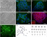 SSEA4 Antibody in Immunocytochemistry (ICC/IF)