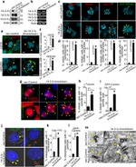 CEP170 Antibody in Immunocytochemistry (ICC/IF)
