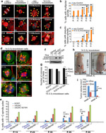 CEP170 Antibody in Immunocytochemistry (ICC/IF)