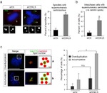 CEP170 Antibody in Immunocytochemistry (ICC/IF)