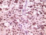 LSD1 Antibody in Immunohistochemistry (IHC)