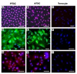 SSEA4 Antibody in Immunohistochemistry, Immunocytochemistry (IHC, ICC/IF)