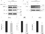 Calcineurin B Antibody in Western Blot (WB)