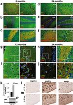 Phospho-Tau (Ser202, Thr205) Antibody in Immunohistochemistry, Immunocytochemistry (IHC, ICC/IF)