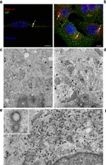 RAB11A Antibody in Immunocytochemistry (ICC/IF)