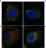 RAB11A Antibody in Immunocytochemistry (ICC/IF)