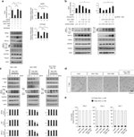 TIP60 Antibody in Western Blot (WB)