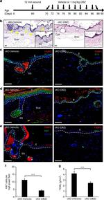 Ki-67 Antibody in Immunohistochemistry (IHC)