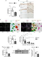 CD45 Antibody in Immunohistochemistry (IHC)