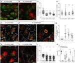 ZO-1 Antibody in Immunocytochemistry (ICC/IF)