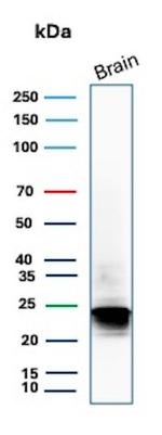 Myelin Basic Protein Antibody in Western Blot (WB)