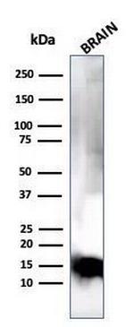 Myelin Basic Protein Antibody in Western Blot (WB)