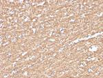 Phospho-Myelin Basic Protein (Marker of Oligodendrocytes and Myelin) (Thr98) Antibody in Immunohistochemistry (Paraffin) (IHC (P))