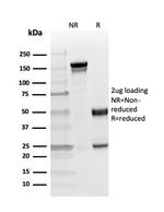 Phospho-Myelin Basic Protein (Marker of Oligodendrocytes and Myelin) (Thr98) Antibody in SDS-PAGE (SDS-PAGE)