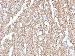 Myelin Basic Protein Monoclonal Antibody (MBP/4273)