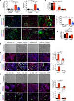 Ki-67 Antibody in Immunohistochemistry (IHC)