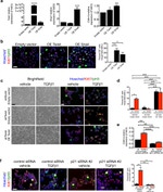 Ki-67 Antibody in Immunohistochemistry (IHC)