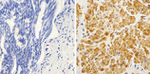 K-Ras Antibody in Immunohistochemistry (Paraffin) (IHC (P))