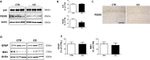 PSD-95 Antibody in Western Blot (WB)