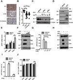 Hepatitis C Virus Core Antigen Antibody in Western Blot (WB)