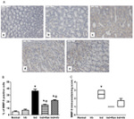 MMP9 Antibody in Immunohistochemistry (IHC)