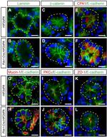 ZO-1 Antibody in Immunohistochemistry (IHC)