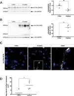 Phospho-Tau (Ser202, Thr205) Antibody in Western Blot (WB)