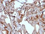 MCAM (Melanoma Cell Adhesion Molecule)/MUC18/CD146 Monoclonal Antibody (MUC18/1130)