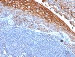 MCAM (Melanoma Cell Adhesion Molecule)/MUC18/CD146 Recombinant Mouse Monoclonal Antibody (rMUC18, 1130)