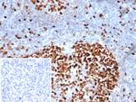 MCM3 (Proliferation Marker) Antibody in Immunohistochemistry (Paraffin) (IHC (P))