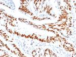 MCM3 (Proliferation Marker) Antibody in Immunohistochemistry (Paraffin) (IHC (P))