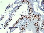 MCM3 (Proliferation Marker) Antibody in Immunohistochemistry (Paraffin) (IHC (P))