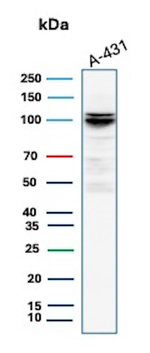 MCM4 (Pan Cancer Marker) Antibody in Western Blot (WB)