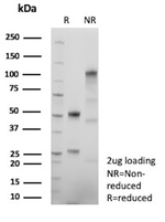 MCM4 (Pan Cancer Marker) Antibody in SDS-PAGE (SDS-PAGE)