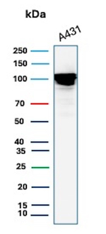 MCM4 (Pan Cancer Marker) Antibody in Western Blot (WB)