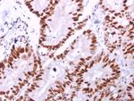 MCM6 (Proliferation Marker) Monoclonal Antibody (MCM6/2999)