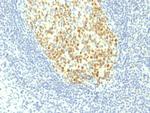 MCM7 (Proliferation Marker) Monoclonal Antibody (MCM7/1467)