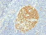 MCM7 (Proliferation Marker) Antibody in Immunohistochemistry (Paraffin) (IHC (P))