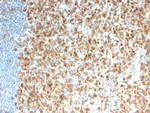 MCM7 Recombinant Mouse Monoclonal Antibody (rMCM7, 1468)