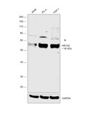 LXR beta Monoclonal Antibody (K8917)