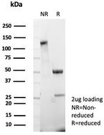MDM2 Antibody in SDS-PAGE (SDS-PAGE)