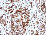 MDM2 Antibody in Immunohistochemistry (Paraffin) (IHC (P))