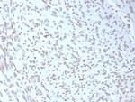 MDM2 Monoclonal Antibody (MDM2/7943)