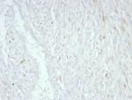 MDM2 Monoclonal Antibody (MDM2/8221)