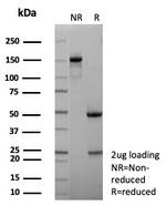 MDM2 Antibody in SDS-PAGE (SDS-PAGE)