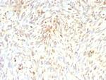 MDM2 Recombinant Mouse Monoclonal Antibody (rMDM2/9214)