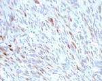 MDM2 Recombinant Rabbit Monoclonal Antibody (MDM2/7190R)