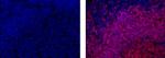 CD20 Monoclonal Antibody (L26), eFluor™ 615, eBioscience™