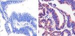 SMAD7 Antibody in Immunohistochemistry (Paraffin) (IHC (P))